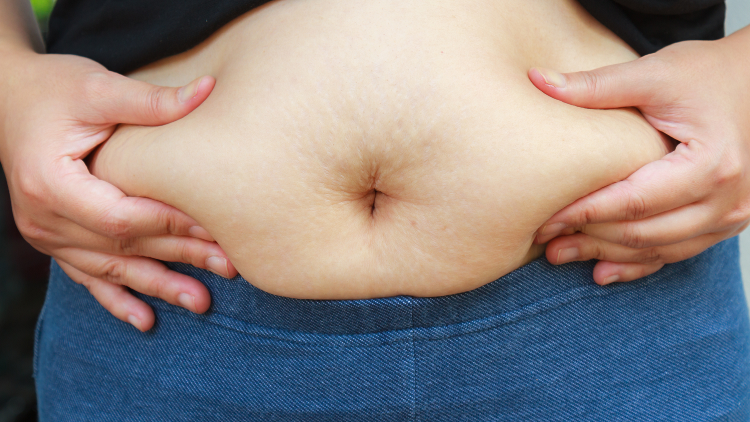 PCOS - Causes of infertility