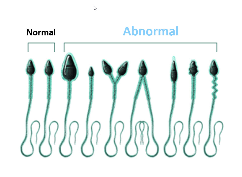 Male Fertility- Sperm Health